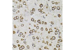 Immunohistochemistry of paraffin-embedded mouse brain using CEP164 antibody. (CEP164 anticorps)