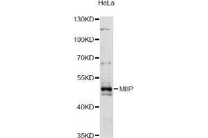 Western blot analysis of extracts of HeLa cells, using MIIP antibody (ABIN6293240) at 1:3000 dilution. (MIIP anticorps)