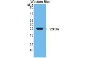 Detection of Recombinant DBP, Rat using Monoclonal Antibody to Vitamin D Binding Protein (DBP) (Vitamin D-Binding Protein anticorps  (AA 209-394))
