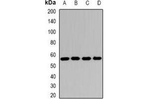Western blot analysis of SCOT expression in Hela (A), Jurkat (B), mouse heart (C), rat kidney (D) whole cell lysates. (OXCT1 anticorps)