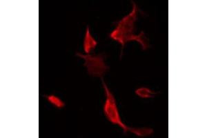 ABIN6266541 staining NIH-3T3 by IF/ICC. (FLI1 anticorps  (Internal Region))