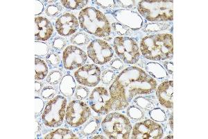 Immunohistochemistry of paraffin-embedded rat kidney using RPS15A Rabbit pAb (ABIN6131092, ABIN6147201, ABIN6147202 and ABIN6214414) at dilution of 1:200 (40x lens).