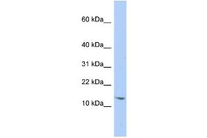 WB Suggested Anti-SNRPD2 Antibody Titration:  0.