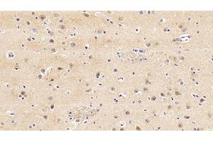Detection of gp130 in Porcine Cerebrum Tissue using Polyclonal Antibody to Glycoprotein 130 (gp130)