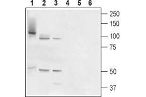 Western blot analysis of rat prostate (lanes 1 and 4), testis (lanes 2 and 5) and placenta (lanes 3 and 6): - 1-3. (TMC6 anticorps  (Cytosolic, Intracellular))