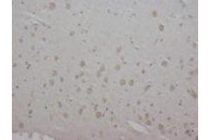 anti-Acetylcholine Receptor Subunit alpha (CHRNA1) (N-Term) antibody