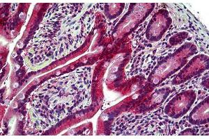 Human Small Intestine: Formalin-Fixed, Paraffin-Embedded (FFPE) (EPH Receptor B6 anticorps  (AA 831-843))