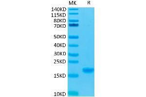 SDS-PAGE (SDS) image for Interleukin 7 (IL7) protein (ABIN7274963)