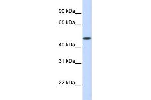 WB Suggested Anti-GLT8D1 Antibody Titration:  0.