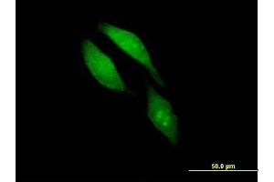 Immunofluorescence of purified MaxPab antibody to BRCC3 on HeLa cell.