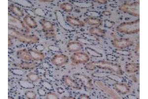 IHC-P analysis of Human Kidney Tissue, with DAB staining. (MAP3K1 anticorps  (AA 1307-1509))
