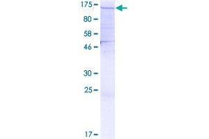Image no. 1 for Splicing Factor 3a, Subunit 1 (SF3A1) (AA 1-793) protein (GST tag) (ABIN1319702)
