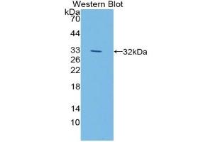 Detection of Recombinant LIPG, Mouse using Polyclonal Antibody to Lipase, Endothelial (LIPG) (LIPG anticorps  (AA 115-369))