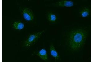 IF analysis of YWHAE using anti-YWHAE antibody (ABIN7600163). (YWHAE anticorps  (AA 16-163))