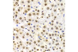 Immunohistochemistry of paraffin-embedded Rat liver using H3K9me3 antibody at dilution of 1:100 (x400 lens). (Histone 3 anticorps  (H3K9me3))