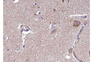 ABIN6268757 at 1/100 staining human brain tissue sections by IHC-P.
