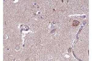 ABIN6268757 at 1/100 staining human brain tissue sections by IHC-P. (FBLN4 anticorps  (Internal Region))