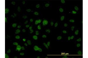 Immunofluorescence of monoclonal antibody to SMARCD2 on HeLa cell. (SMARCD2 anticorps  (AA 398-474))