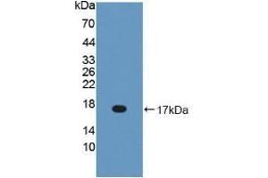 Detection of Recombinant BPI, Mouse using Polyclonal Antibody to Bactericidal/Permeability Increasing Protein (BPI) (BPI anticorps  (AA 320-457))