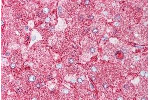 Human Liver (formalin-fixed, paraffin-embedded) stained with MINK1 antibody ABIN213551 at 5 ug/ml followed by biotinylated goat anti-rabbit IgG secondary antibody ABIN481713, alkaline phosphatase-streptavidin and chromogen.