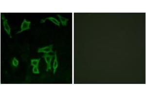 Immunofluorescence analysis of LOVO cells, using GRM5 Antibody. (Metabotropic Glutamate Receptor 5 anticorps  (AA 21-70))
