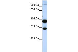 WB Suggested Anti-ZNF138 Antibody Titration:  0. (ZNF138 anticorps  (C-Term))