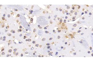 Detection of HSPA5 in Mouse Cerebrum Tissue using Monoclonal Antibody to Heat Shock 70 kDa Protein 5 (HSPA5)