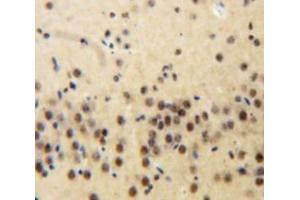 Used in DAB staining on fromalin fixed paraffin-embedded Brain tissue (Plakophilin 2 anticorps  (AA 571-849))