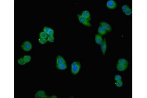 Immunofluorescent analysis of PC-3 cells using ABIN7164927 at dilution of 1:100 and Alexa Fluor 488-congugated AffiniPure Goat Anti-Rabbit IgG(H+L)