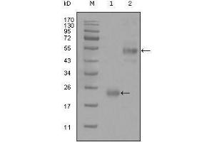 Western blot analysis using CD44 mouse mAb against truncated Trx-CD44 recombinant protein (1) and GST-CD44 (aa628-699) recombinant protein (2). (CD44 anticorps)