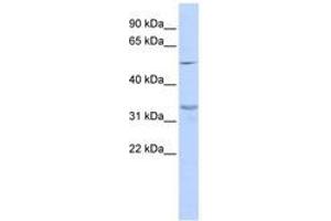 Image no. 1 for anti-Zinc Finger Protein 765 (ZNF765) (AA 288-337) antibody (ABIN6741084) (ZNF765 anticorps  (AA 288-337))