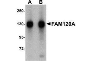 Western blot analysis of FAM120A in SK-N-SH cell lysate with AP30329PU-N FAM120A antibody at (A) 0. (FAM120A anticorps  (Center))
