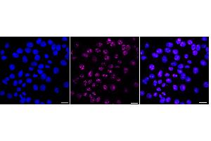 Immunocytochemical staining of HepG2 cells with Paired box 9 antibody (ABIN7799727), 1:1,000).