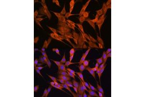 Immunofluorescence analysis of NIH-3T3 cells using S100 Rabbit pAb (ABIN6128693, ABIN6147339, ABIN6147340 and ABIN6214636) at dilution of 1:100 (40x lens).