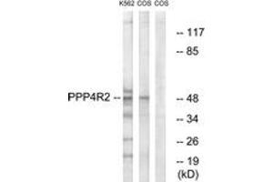 Western Blotting (WB) image for anti-Protein Phosphatase 4, Regulatory Subunit 2 (PPP4R2) (AA 171-220) antibody (ABIN2890625) (PPP4R2 anticorps  (AA 171-220))