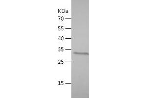 Western Blotting (WB) image for SWI/SNF Related, Matrix Associated, Actin Dependent Regulator of Chromatin, Subfamily A-Like 1 (SMARCAL1) (AA 683-954) protein (His-IF2DI Tag) (ABIN7125263)