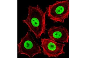 Fluorescent image of MCF-7 cells stained with (Rat) Cdk4 Antibody (C-term) B.