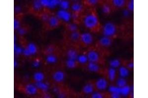 Immunofluorescence analysis of Mouse kidney tissue using AMACR Monoclonal Antibody at dilution of 1:200.