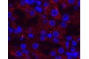Immunofluorescence analysis of Mouse kidney tissue using AMACR Monoclonal Antibody at dilution of 1:200. (AMACR anticorps)