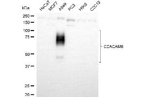 Western blotting analysis using CEACAM6 antibody (ABIN7797876).