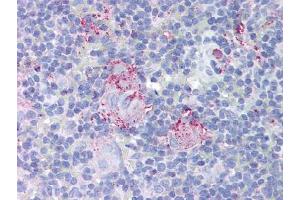 Image no. 1 for anti-Mdm2, p53 E3 Ubiquitin Protein Ligase Homolog (Mouse) (MDM2) antibody (ABIN302837) (MDM2 anticorps)