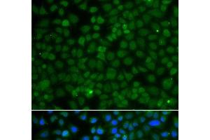 Immunofluorescence analysis of A549 cells using WDR45 Polyclonal Antibody (WDR45 anticorps)