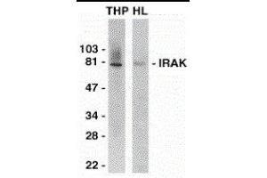Western Blotting (WB) image for anti-Interleukin-1 Receptor-Associated Kinase 1 (IRAK1) (C-Term) antibody (ABIN2475130)
