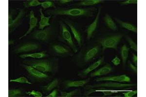Immunofluorescence of purified MaxPab antibody to NARS on HeLa cell. (NARS anticorps  (AA 1-548))