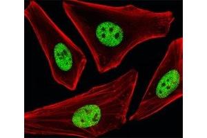 Fluorescent image of HeLa cells stained with SP1 antibody at 1:25 dilution.