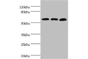 Western blot All lanes: Glutamate dehydrogenase 2, mitochondrial antibody at 4 μg/mL Lane 1: Mouse brain tissue Lane 2: 293T whole cell lysate Lane 3: Rat brain tissue Secondary Goat polyclonal to rabbit IgG at 1/10000 dilution Predicted band size: 61 kDa Observed band size: 61 kDa (GLUD2 anticorps  (AA 319-558))