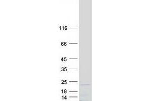 Validation with Western Blot