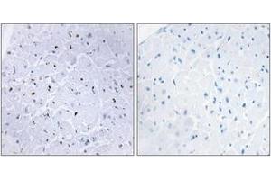 Immunohistochemistry analysis of paraffin-embedded human heart, using 53BP1 (Phospho-Ser6) Antibody.