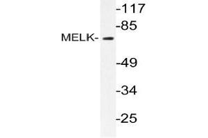 Western blot (WB) analysis of MELK antibody in extracts from k562 cells.