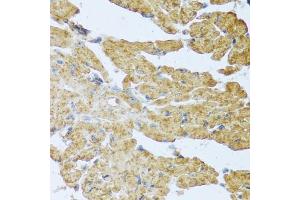 Immunohistochemistry of paraffin-embedded mouse heart using IL20 antibody (ABIN6128133, ABIN6142353, ABIN6142354 and ABIN6222322) at dilution of 1:100 (40x lens). (IL-20 anticorps  (AA 25-176))